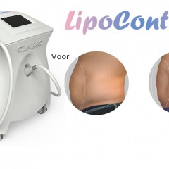 De award winnende Schoonheidssalon Delia combineert twee cryo technieken.