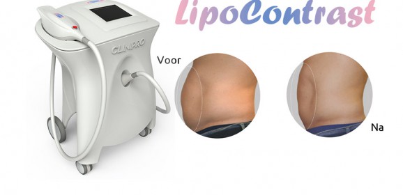 De award winnende Schoonheidssalon Delia combineert twee cryo technieken.